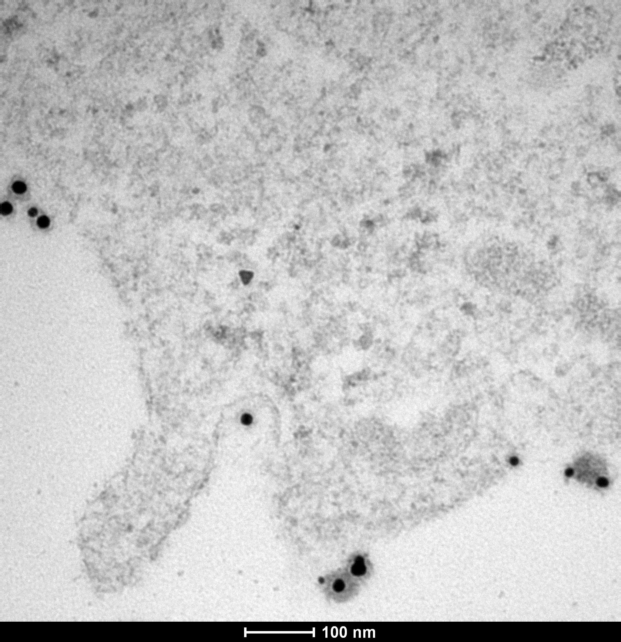 Gold nanoparticles entering a melanoma cell